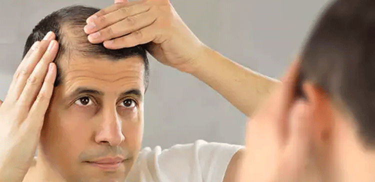 اگر آپ اچانک بالوں کے گرنے سے پریشان ہیں تو ان غذاؤں کے استعمال کو اپنی عادت بنا کر فرق دیکھیں 