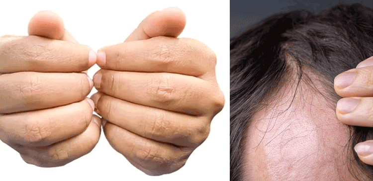 بال ٹوٹ رہے ہیں تو صرف 10 منٹ تک یہ طریقہ آزمائیں اور کمال دیکھیں