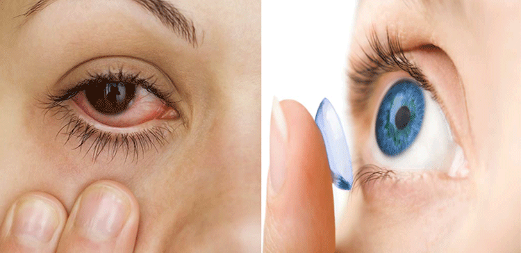  11 احتیاطی تدابیر جو آپ کو آنکھوں کے انفیکشن سے بچاسکتی ہیں