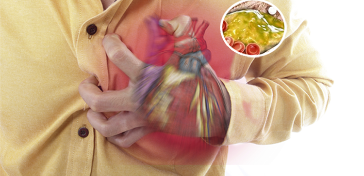 ہائی کولیسٹرول کیا ہوتا ہے اور اسے کیسے کم کرسکتے ہیں؟