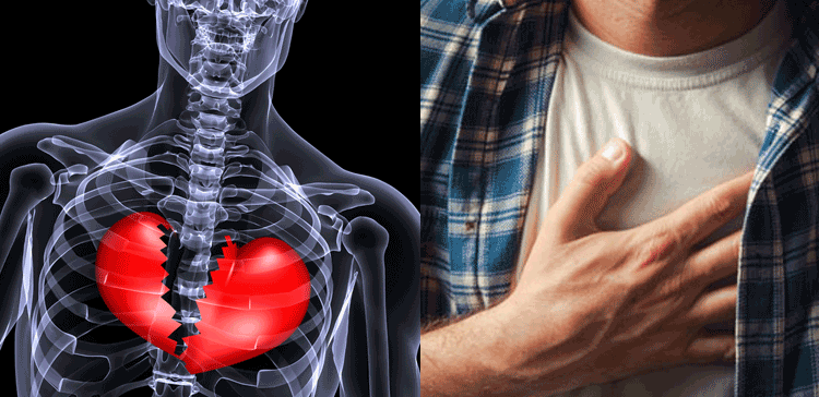 کیا حقیقت میں بھی دل ٹوٹتا ہے، کیا آپ جانتے ہیں کہ دل ٹوٹنا ایک بیماری بھی ہے؟