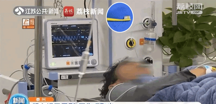 چینی شہری دانت صاف کرتے کرتے ٹوتھ برش ہی نگل گیا