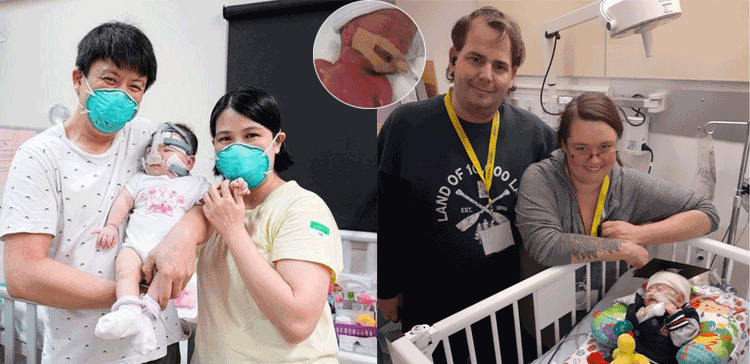 قبل از وقت پیدا ہونے والے کچھ ایسے بچے جن کے حوصلوں نے موت کو شکست دی