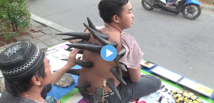 لوگ اپنے جسم پر بھینسے کے سینگ کیوں لگوا رہے ہیں؟ حیرت انگیز عمل کی ویڈیو وائرل