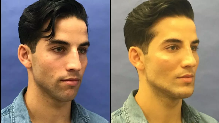 موٹی ناک کو خوبصورت کیسے بنائیں؟ جانیے ناک کی خوبصورتی بڑھانے کی کچھ ٹپس