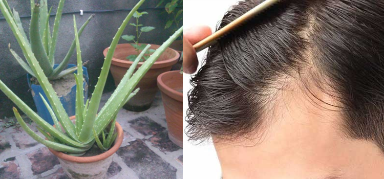 ایلوویرا میں موجود ہر مسئلے کا حل۔۔ فائدے جان کر آپ اسے گھر پر اگانے پر مجبور ہوجائیں گے