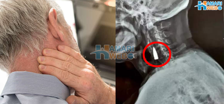 77 سال سے گردن میں موجود گولی کے ساتھ زندہ رہنے والا شخص 