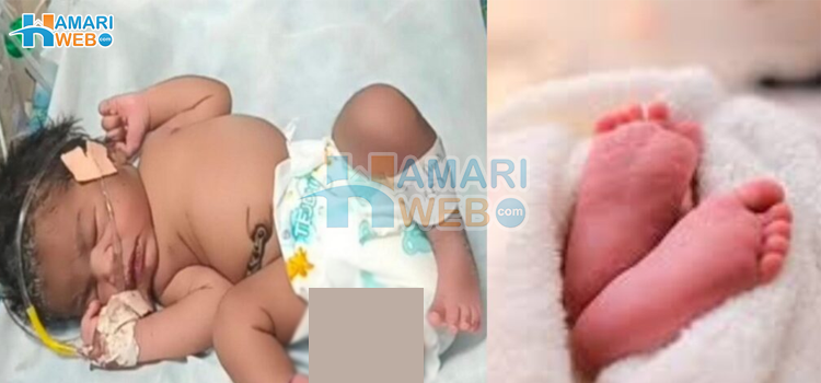 چار ٹانگوں والی بچی کی پیدائش، بچے اضافی اعضاﺀ کے ساتھ کب اور کیوں پیدا ہوتے ہیں؟