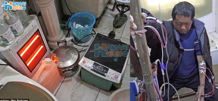 13 سالوں سے انوکھے انداز میں اپنے ڈائلیسس خود کرنے والا انوکھا انسان