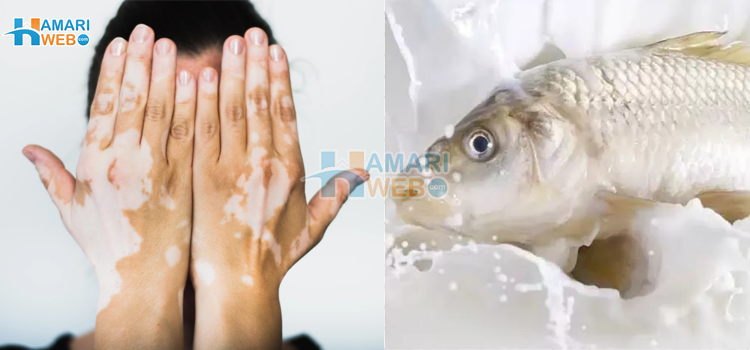کیا واقعی مچھلی کھا کر دودھ پینے سے برص ہو سکتا ہے؟