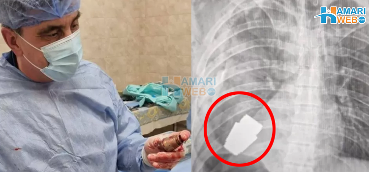 سینے سے گرینیڈ نکالنے کا مشکل ترین آپریشن جسے خوشی کا جھٹکا قرار دیا گیا