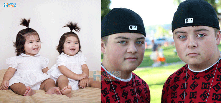 جڑواں بچوں سے متعلق چند دلچسپ حقائق اور غلط فہمیاں