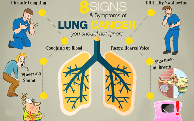 Some Common Signs Of Lung Cancer