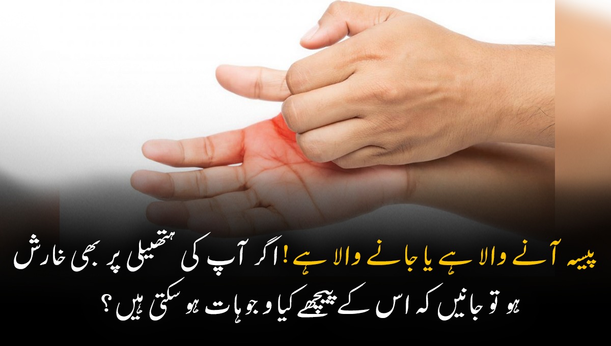 پیسہ آنے والا ہے یا جانے والا ہے! اگر آپ کی ہتھیلی پر بھی خارش ہو تو جانیں کہ اس کے پیچھے کیا وجوہات ہو سکتی ہیں؟