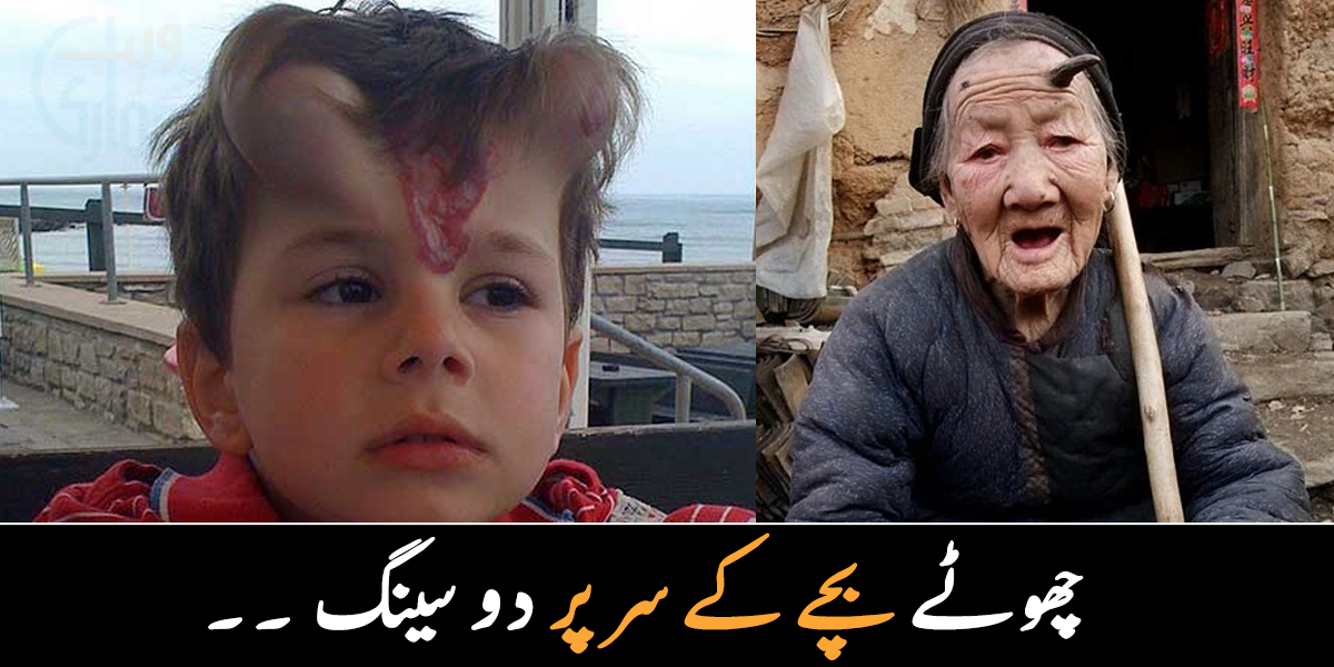 کسی کے سر پر دو سینگ ہیں، تو کسی ایک ۔۔ جانیے ان تین لوگوں کے بارے میں، جن کے سینگوں نے انہیں مشہور کر دیا