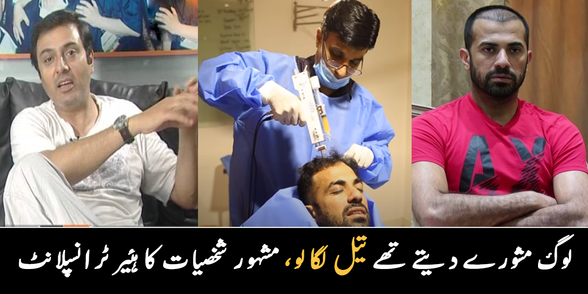 انہیں تیل لگانے کے مشورے دیے مگر ۔۔ مشہور شخصیات نے ہئیر ٹرانسپلانٹ کرایا، اب کیسے دکھائی دے رہے ہیں؟