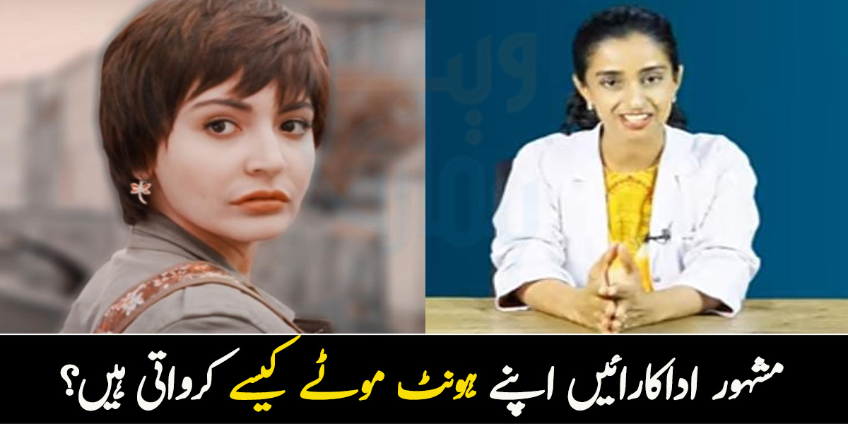 ہونٹ پتلے ہیں تو موٹے کروالو.. لپ فلرز کیا ہوتے ہیں اور مشہور اداکارائیں ان سے کس طرح اپنے ہونٹ موٹے کرواتی ہیں؟