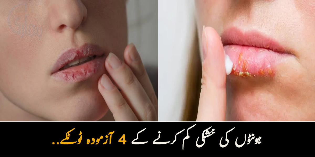 سردی میں ہونٹوں کو پھٹنے سے کیسے بچائیں؟ چند ایسے طریقے جس سے آپ ہونٹوں کی خشکی کم کرسکتے ہیں
