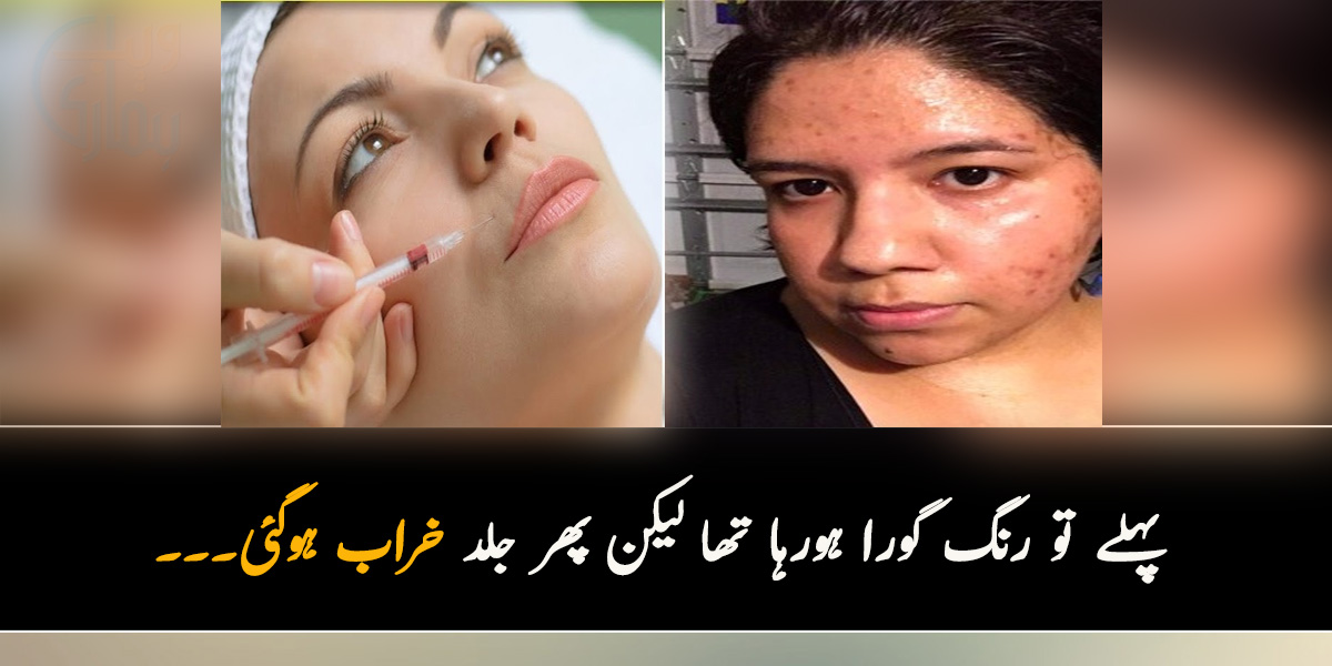 پہلے تو رنگ گورا ہورہا تھا لیکن پھر جلد خراب ہوگئی۔۔۔ کیا رنگ گورا کرنے والے انجیکشن واقعی نقصان دہ ہوتے ہیں؟