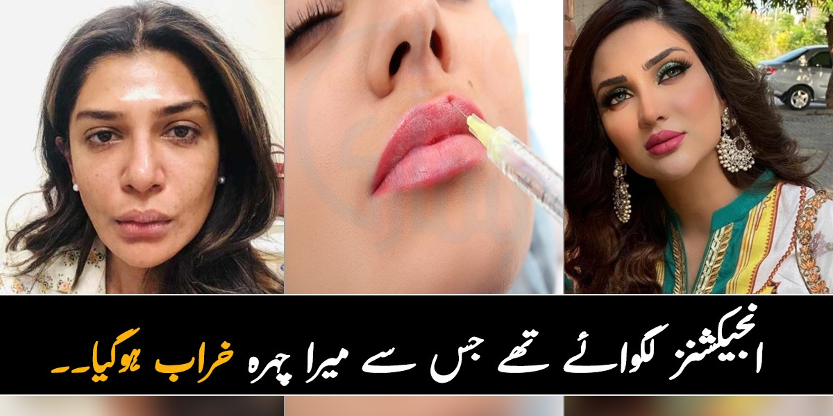 انجیکشنز لگوائے تھے جس سے میرا چہرہ خراب ہوگیا۔۔۔ اداکارائیں ہونٹوں پر انجیشنز کیوں لگواتی ہیں اور اس کے کیا نقصانات ہیں؟