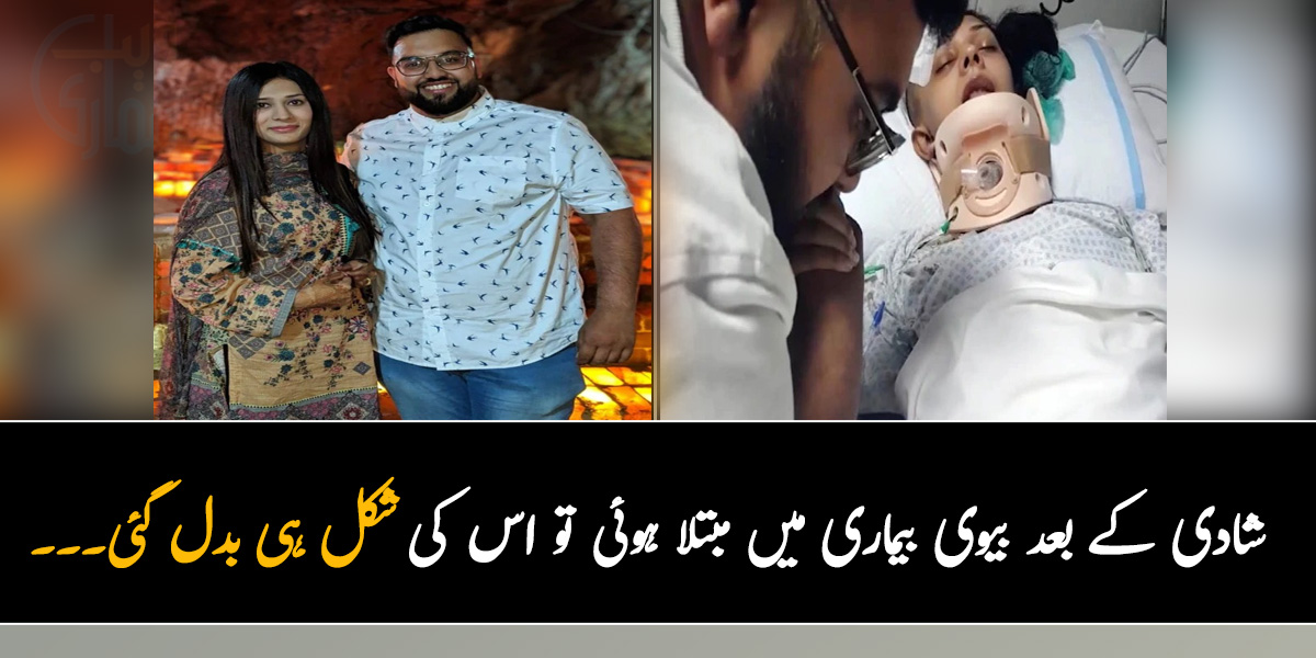 شادی کے بعد بیوی بیماری میں مبتلا ہوئی تو اس کی شکل ہی بدل گئی۔۔۔ جانیں اس شخص  نے بیوی کی جان بچانے کے لئے کیا انوکھا کیا؟ 