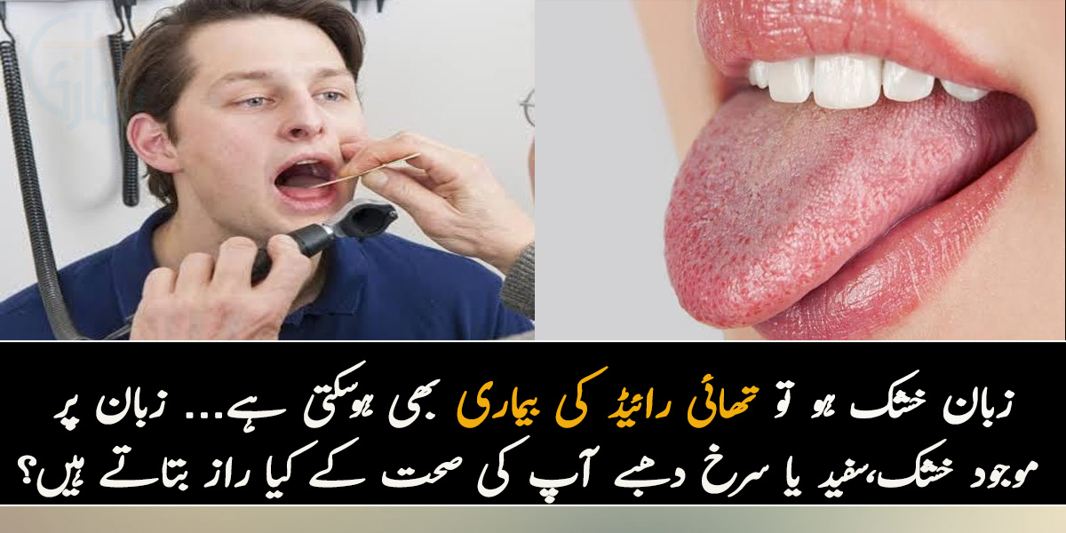 زبان خشک ہو تو تھائی رائیڈ کی بیماری بھی ہوسکتی ہے... زبان پر موجود خشک، سفید یا سرخ دھبے آپ کی صحت کے کیا راز بتاتے ہیں؟
