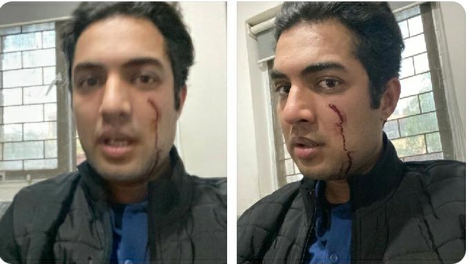 اقرار الحسن پر نا معلوم افراد کا قاتلانہ حملہ، ملزم فائرنگ کر کے فرار