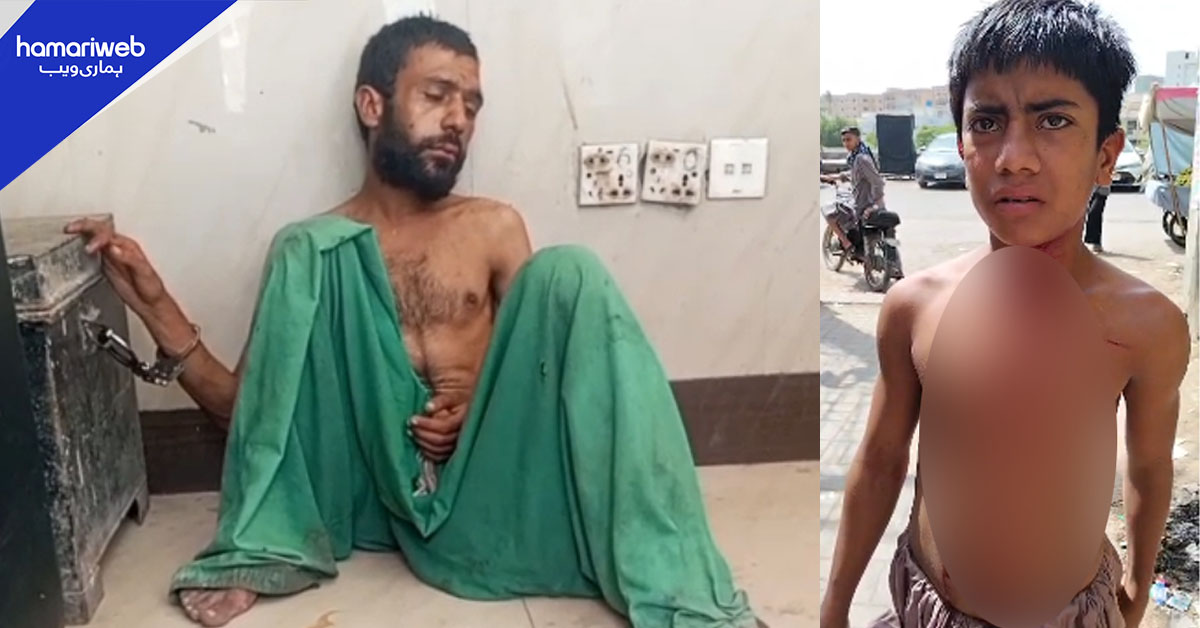 کراچی میں نشئی نے 20 روپے نہ دینے پر لڑکے کے گلے پر بلیڈ پھیر دیا
