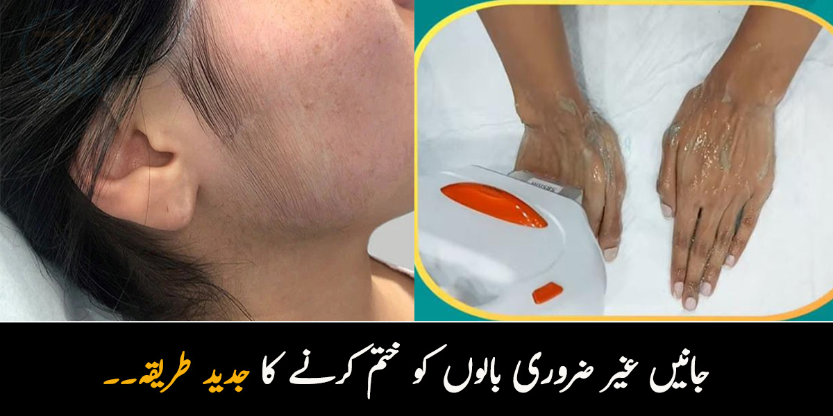 کیا آپ بھی غیر ضروری بالوں سے پریشان ہیں؟ ان کو ختم کرنے کا ایسا طریقہ جو آج کل مشہور بیوٹی پارلرز بھی استعمال کررہے ہیں