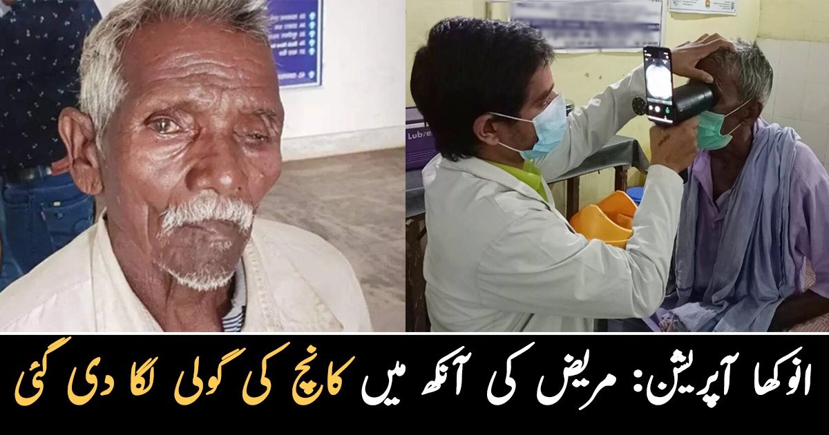 میری آنکھ سے شیشہ نکل آیا.. اس شخص کے ساتھ ایسا کیوں ہوا؟ عجیب و غریب واقعہ جس نے سب کو حیران کردیا