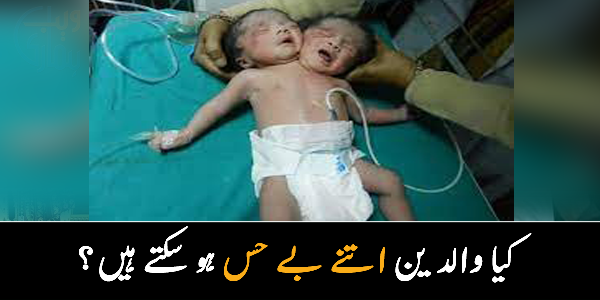 بچے کے دو سر ہیں، ہم نہیں سنبھال سکتے ۔۔ غیر معمولی بچہ پیدا ہونے پر والدین نے کیا کیا؟