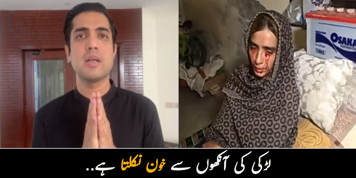 لڑکی کی آنکھوں سے خون نکلتا ہے.. جانیے بیماری کا ڈرامہ کرکے لاکھوں روپے لوٹنے والی لڑکی کے بارے میں اقرار الحسن نے کیا انکشاف کردیا؟