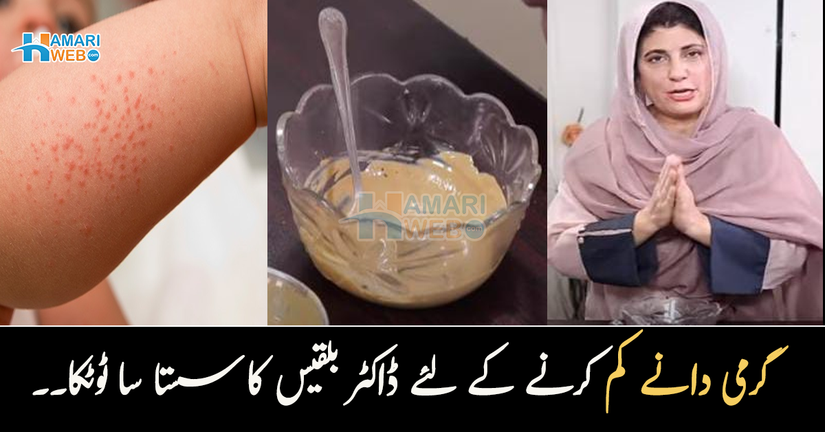 گرمی دانوں پر یہ سستی چیز لگائی۔۔ ڈاکٹر بلقیس کا بتایا ایسا ٹوٹکا جس سے گرمی میں بھی ٹھنڈ لگنی شروع ہوجائے