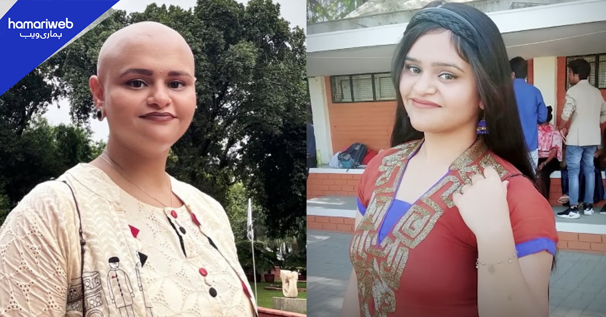 دو سال کی عمر میں گنج پن کا شکار ہونے والی خاتون کے فیصلے نے سب کے دل جیت لیے