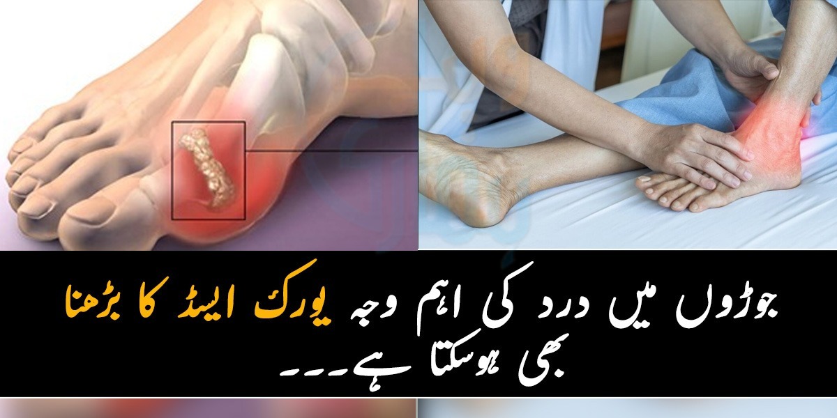 جوڑوں میں درد ہے تو کہیں یورک ایسڈ تو نہیں بڑھ گیا۔۔ یورک ایسڈ کو کنٹرول کرنے کے لئے ڈاکٹر کون سے طریقے بتاتے ہیں؟ جانیے ان کی رائے