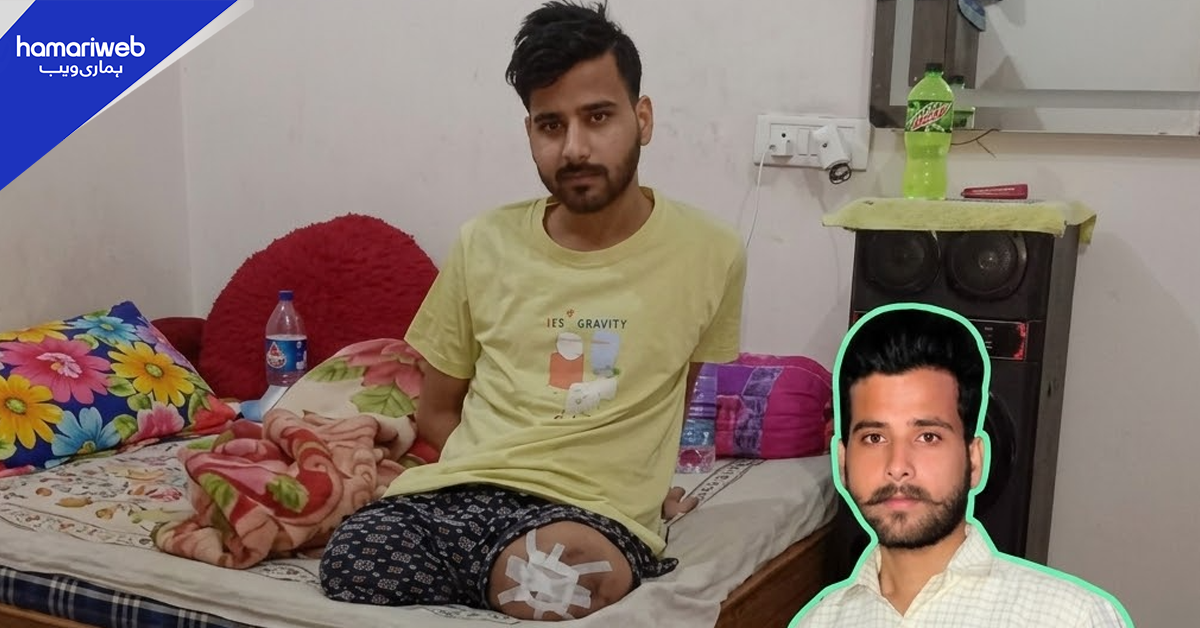 ٹرین حادثے میں دونوں بازو گنوانے والا نوجوان دوبارہ زندگی شروع کرنے کا خواہش مند