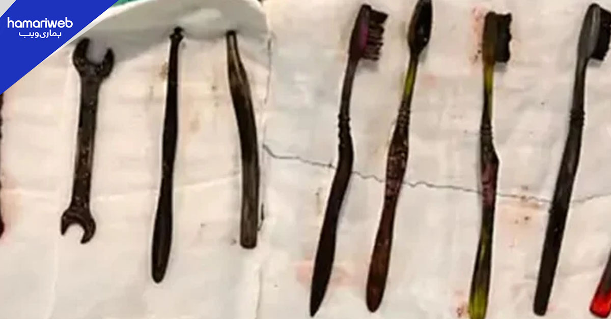 بھارت میں نوجوان کے معدے سے 7 ٹوتھ برش اور 2 پانے نکال لیے گئے