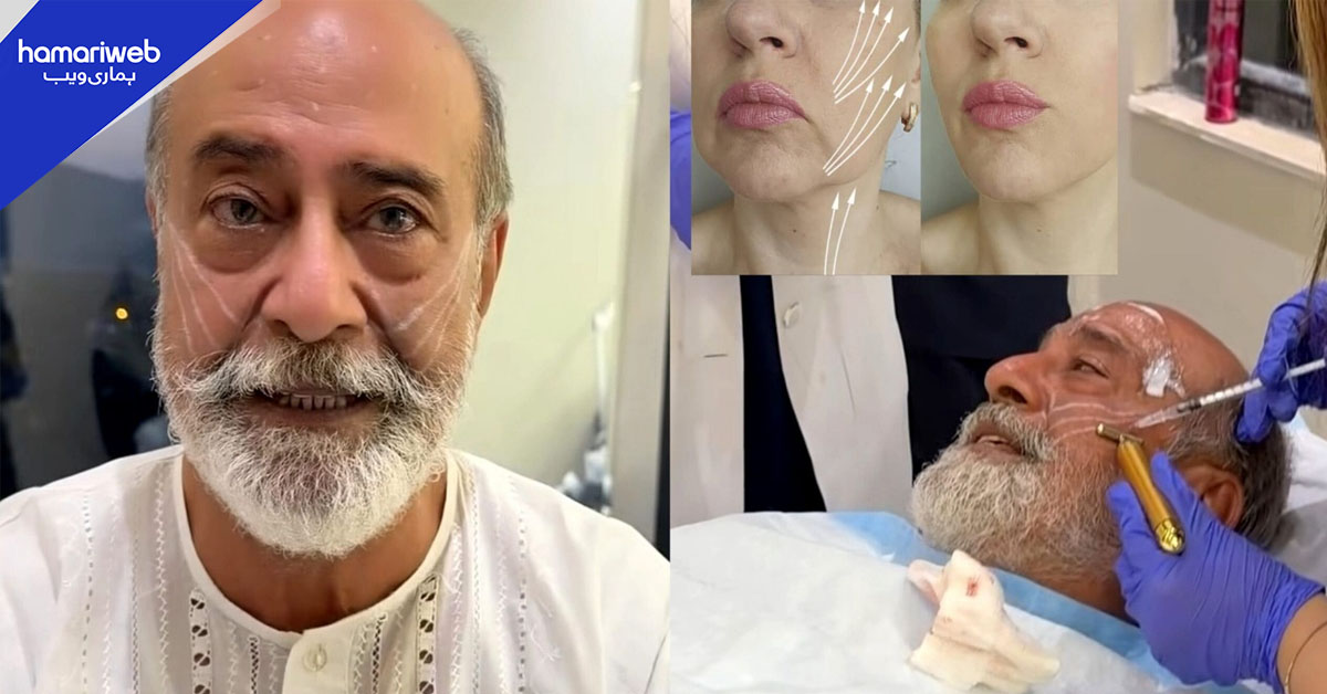 معروف اداکار محمد احمد نے چہرے کی سرجری کروالی، نئی تصاویر پر مداح حیران