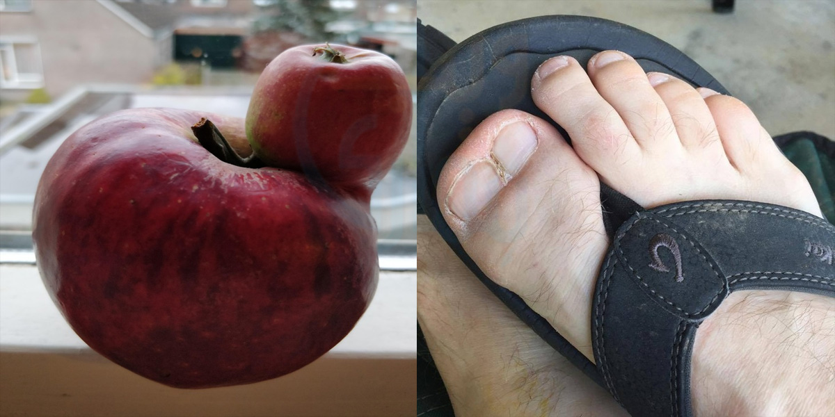  کسی کے ہاتھ میں 3 انگلیاں اور کسی کے 2 ناخن کیوں ہیں؟ ایسی عجیب و غریب تصویریں جو آج سے پہلے آپ نے کبھی نہیں دیکھی ہوں گی