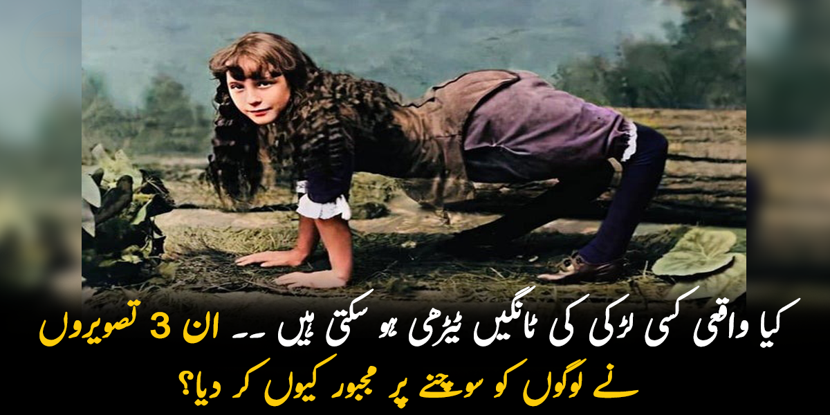 کیا واقعی کسی لڑکی کی ٹانگیں ٹیڑھی ہو سکتی ہیں ۔۔ ان 3 تصویروں نے لوگوں کو سوچنے پر مجبور کیوں کر دیا؟ جانیے ان کے بارے میں دلچسپ سچ