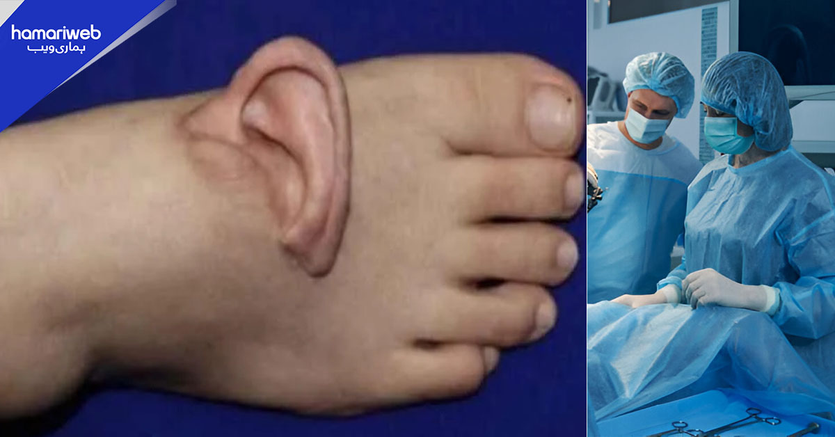 چینی سرجنز نے خاتون کے کٹے ہوئے کان کی پاؤں میں پیوندکاری کیوں کردی؟