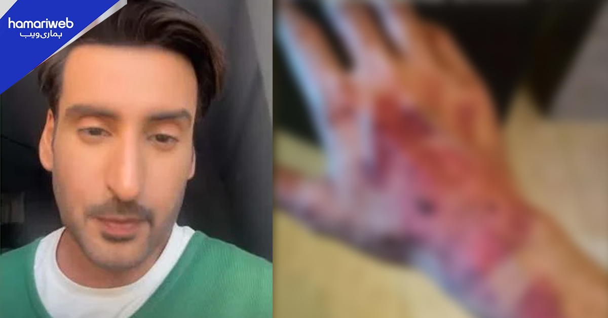  خون آلود ہاتھ مگر ہمت نہ ہاری! آغا علی ایکشن سین کے دوران زخمی پھر بھی شوٹنگ جاری رکھی 