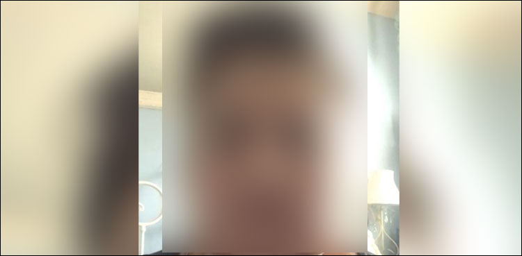 کاسمیٹک ٹریٹمنٹ کے بعد خاتون کی حالت خوفناک، حیران کُن تصاویر سامنے آگئیں