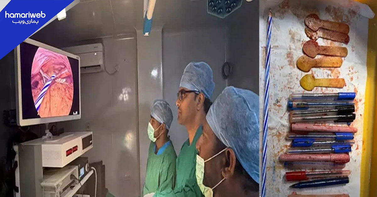 بھارت میں انوکھا طبی واقعہ، خاتون کے معدے سے قلم، چمچ اور موم بتی برآمد