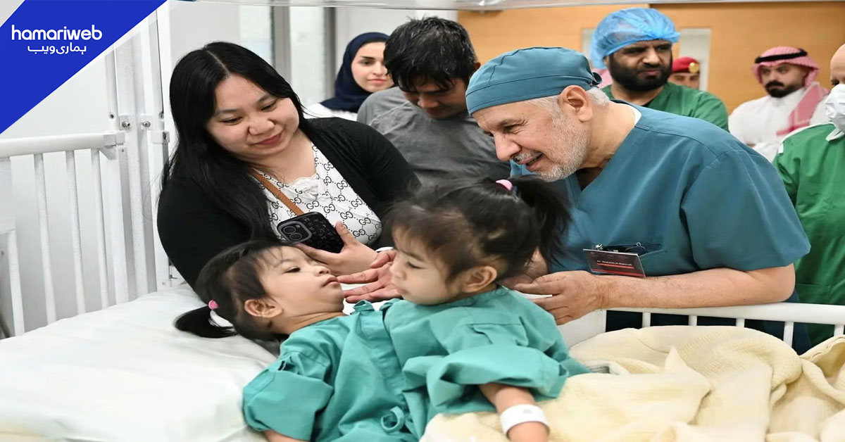سعودی عرب میں دھڑ جڑی بچیوں کا انتہائی نازک آپریشن کامیاب، ماں خوشی سے نڈھال 