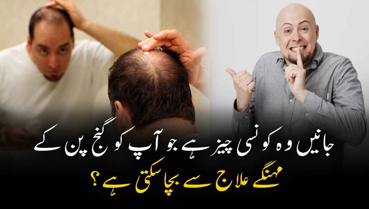 گنجا پن صرف اس چیز کو سونگھنے سے بھی ختم ہوسکتا ہے ، جانیں وہ کونسی چیز ہے جو آپ کو گنج پن کے مہنگے علاج سے بچا سکتی ہے