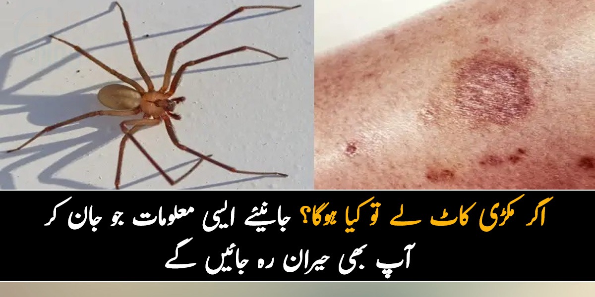گھر میں مکڑی کے جالے ہیں ۔۔ اگر مکڑی کاٹ لے تو کیا ہوگا؟ جانیئے ایسی معلومات جو جان کر آپ بھی حیران رہ جائیں گے
