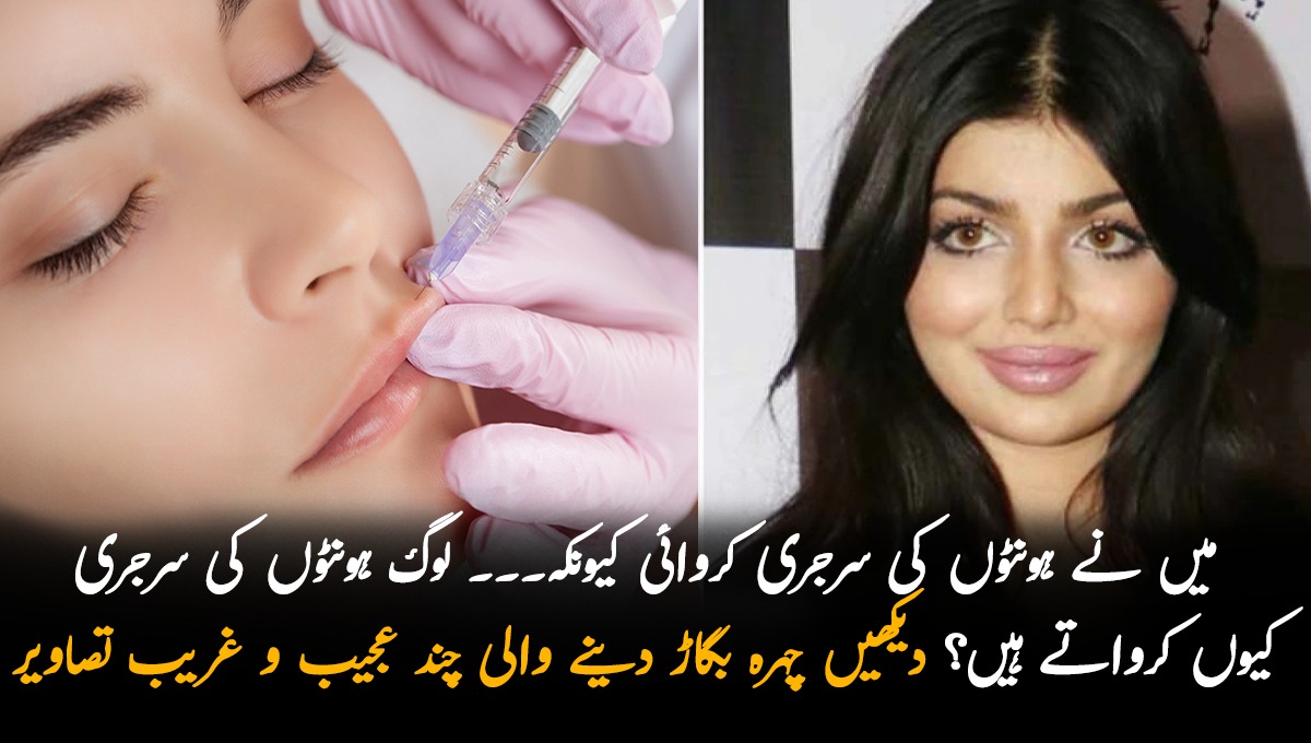 میں نے ہونٹوں کی سرجری کروائی کیونکہ میری امی کہتی تھی کہ یہ عجیب لگتے ہیں۔۔۔ لوگ ہونٹوں کی سرجری کیوں کرواتے ہیں؟ دیکھیں چہرہ بگاڑ دینے والی چند عجیب و غریب تصاویر