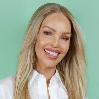 Katie Piper