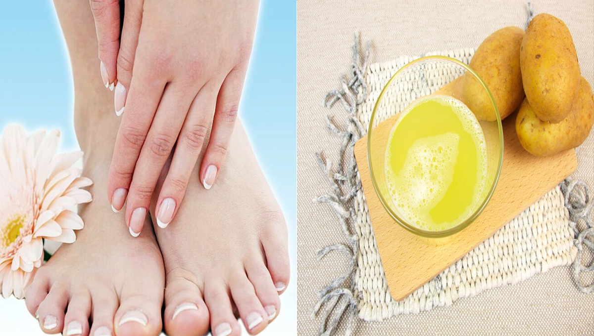 ہاتھوں اور پیروں کا رنگ صاف کرنے کے لیے آلو کے رس میں یہ چیزیں ملاکر لگائیں چند دن میں ہاتھ پاؤں کا رنگ صاف ہوتا جائے گا